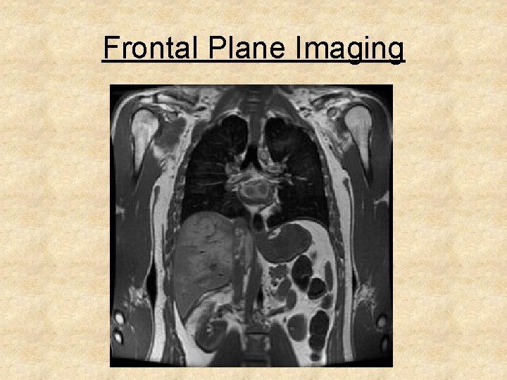 Frontal Plane Imaging 