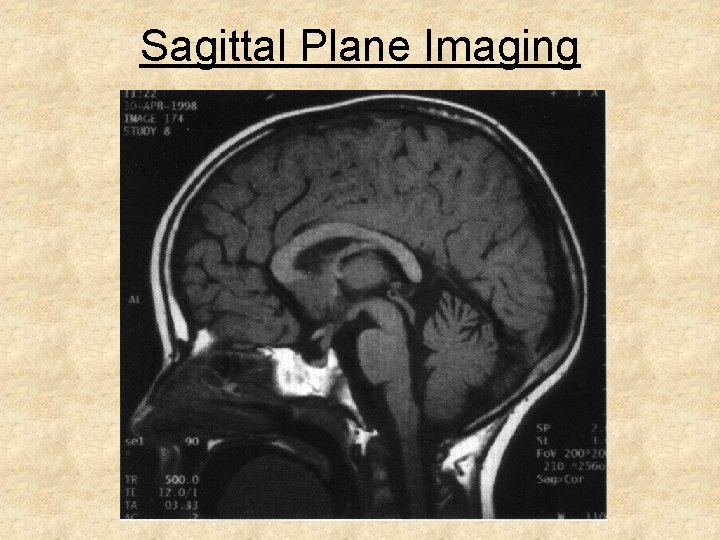 Sagittal Plane Imaging 