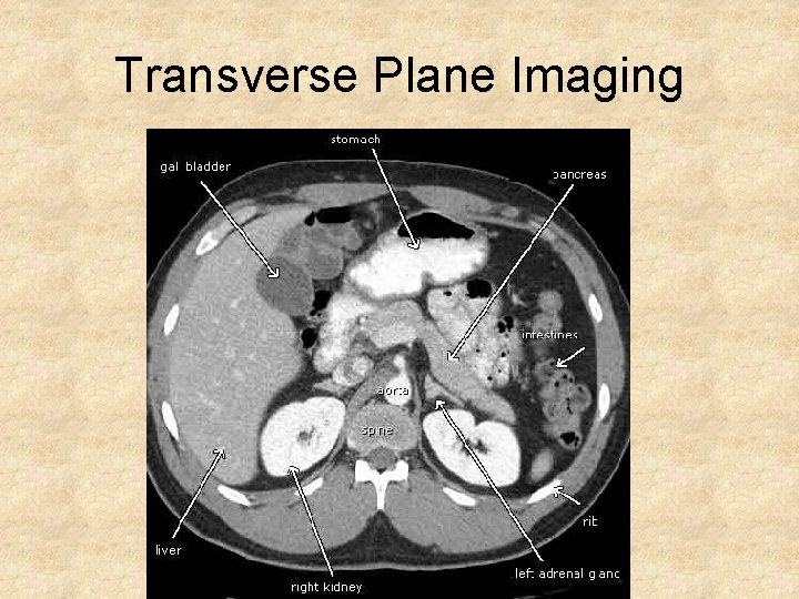 Transverse Plane Imaging 