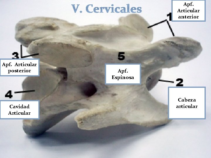 V. Cervicales Apf. Articular posterior Cavidad Articular Apf. Articular anterior Apf. Espinosa Cabeza articular