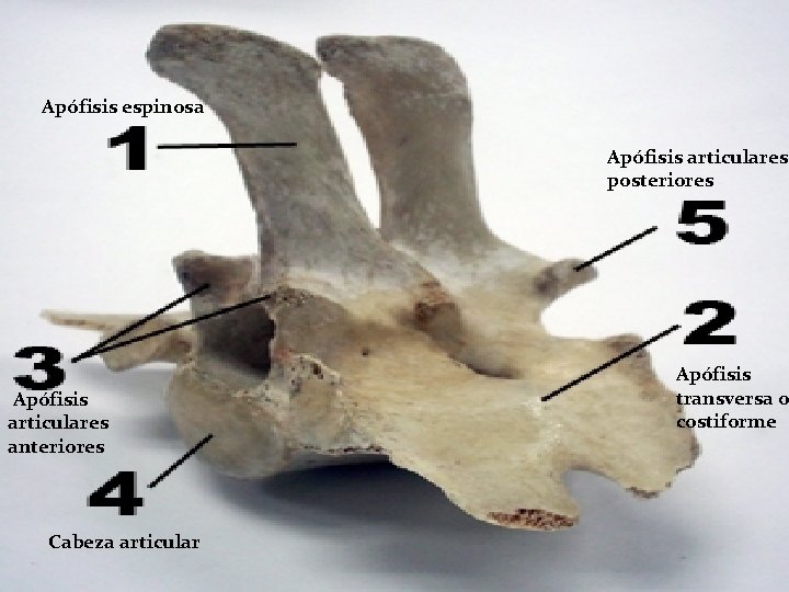 Apófisis espinosa Apófisis articulares posteriores Apófisis articulares anteriores Cabeza articular Apófisis transversa o costiforme