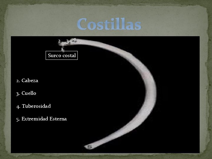 Costillas 2 3 4 1 Surco costal 2. Cabeza 3. Cuello 4. Tuberosidad 5.