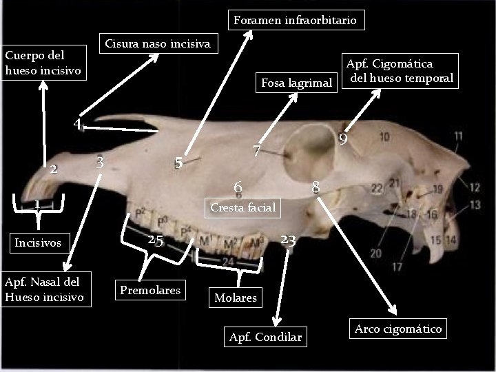 Foramen infraorbitario Cisura naso incisiva Cuerpo del hueso incisivo Fosa lagrimal 4 2 3