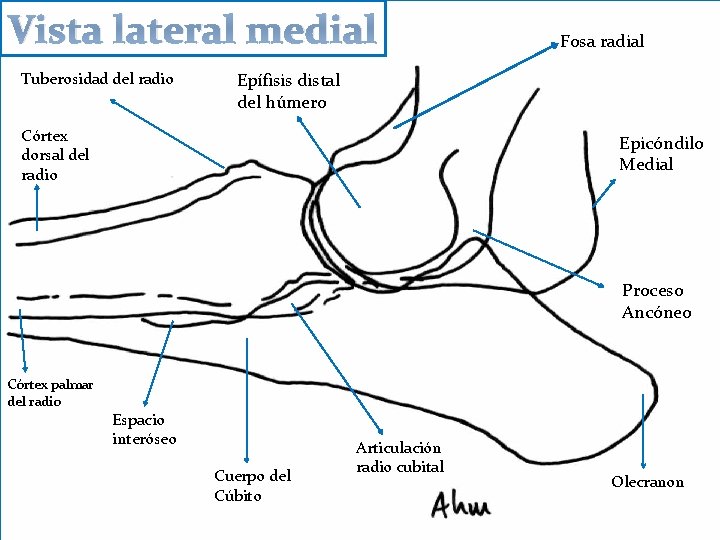 Vista lateral medial Tuberosidad del radio Fosa radial Epífisis distal del húmero Córtex dorsal