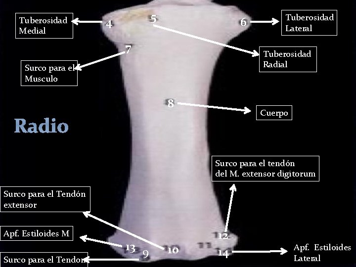 Tuberosidad Medial 5 4 6 7 Tuberosidad Lateral Tuberosidad Radial Surco para el Musculo