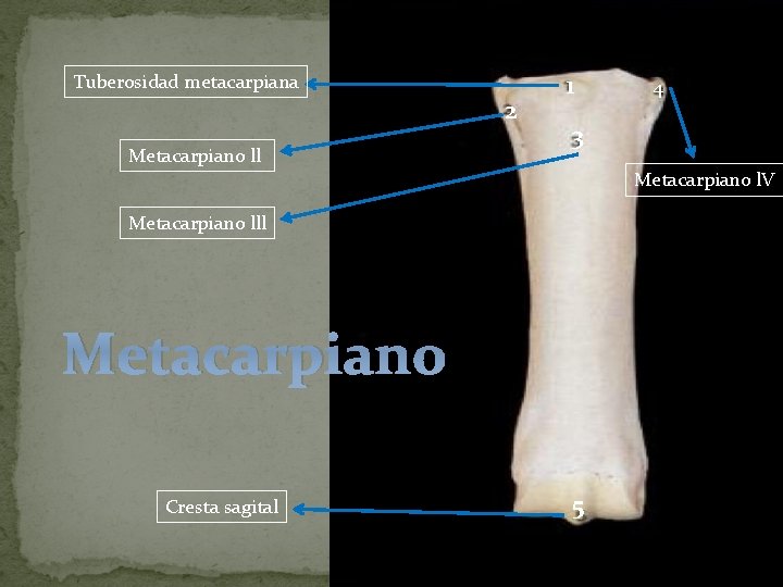 Tuberosidad metacarpiana 2 Metacarpiano ll 1 4 3 Metacarpiano l. V Metacarpiano lll Metacarpiano