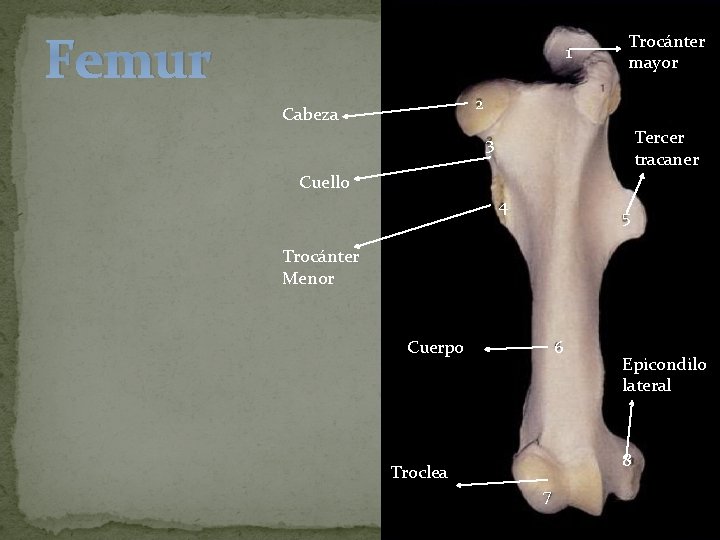 Femur 1 Trocánter mayor 2 Cabeza Tercer tracaner 3 Cuello 4 5 Trocánter Menor