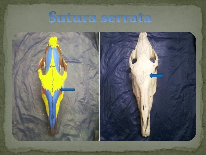 Sutura serrata 