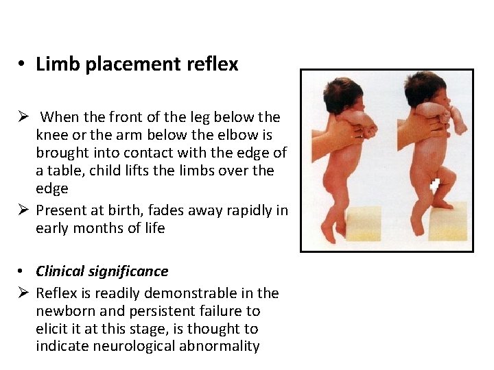  • Limb placement reflex Ø When the front of the leg below the