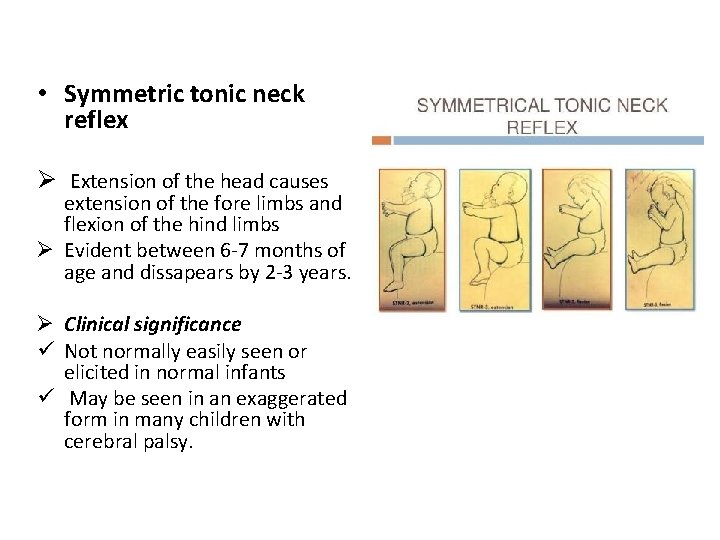  • Symmetric tonic neck reflex Ø Extension of the head causes extension of