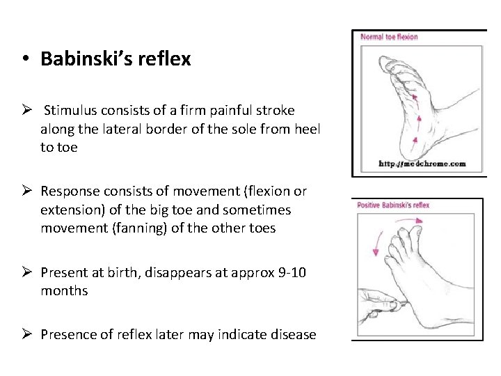 • Babinski’s reflex Ø Stimulus consists of a firm painful stroke along the