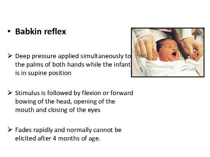  • Babkin reflex Ø Deep pressure applied simultaneously to the palms of both