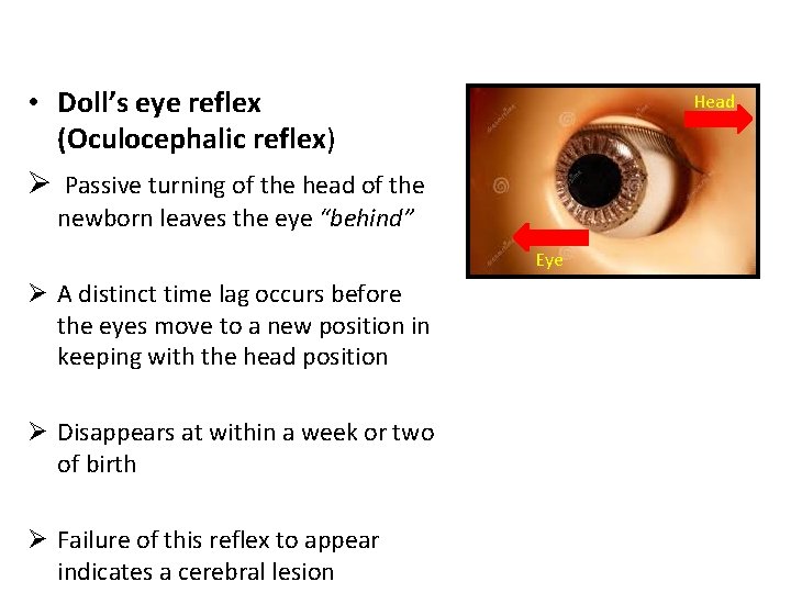  • Doll’s eye reflex (Oculocephalic reflex) Ø Passive turning of the head of