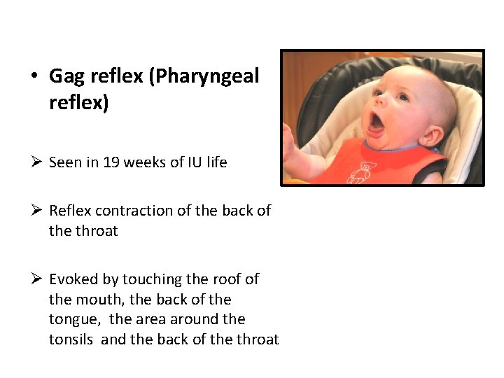  • Gag reflex (Pharyngeal reflex) Ø Seen in 19 weeks of IU life