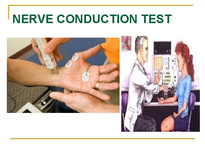 NERVE CONDUCTION TEST 