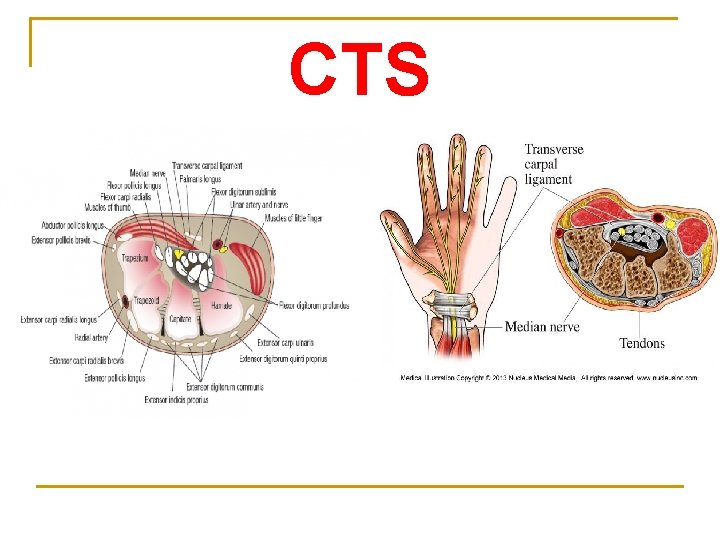 CTS 