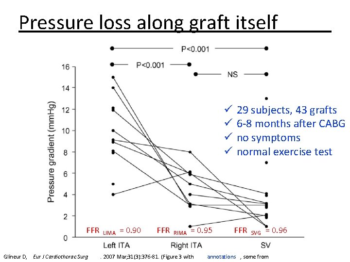 Pressure loss along graft itself ü ü FFR Glineur D, Eur J Cardiothorac Surg
