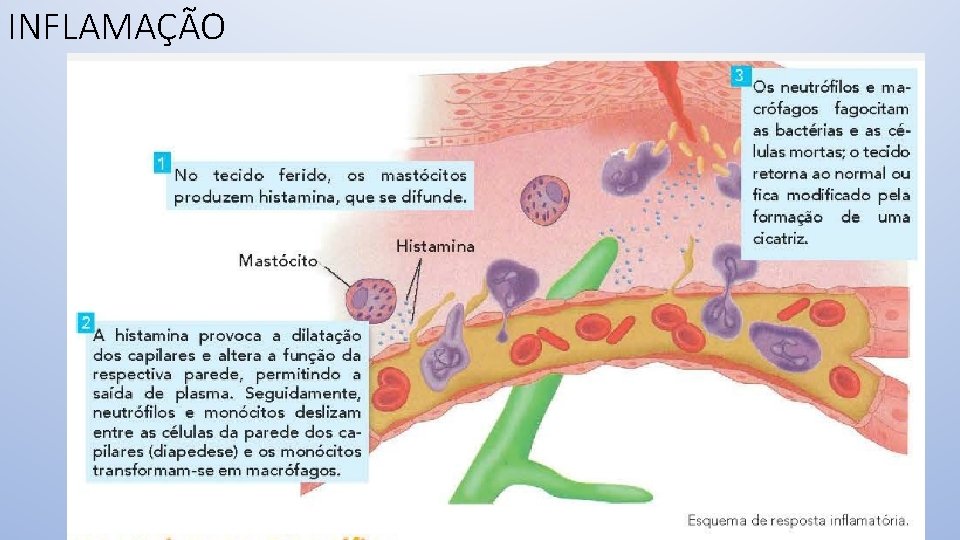 INFLAMAÇÃO 