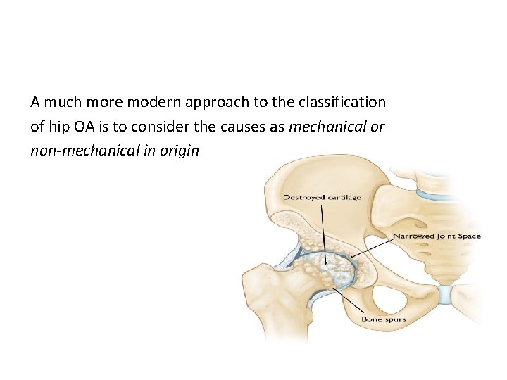 A much more modern approach to the classification of hip OA is to consider