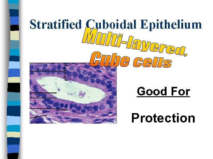 Stratified Cuboidal Epithelium Good For Protection 