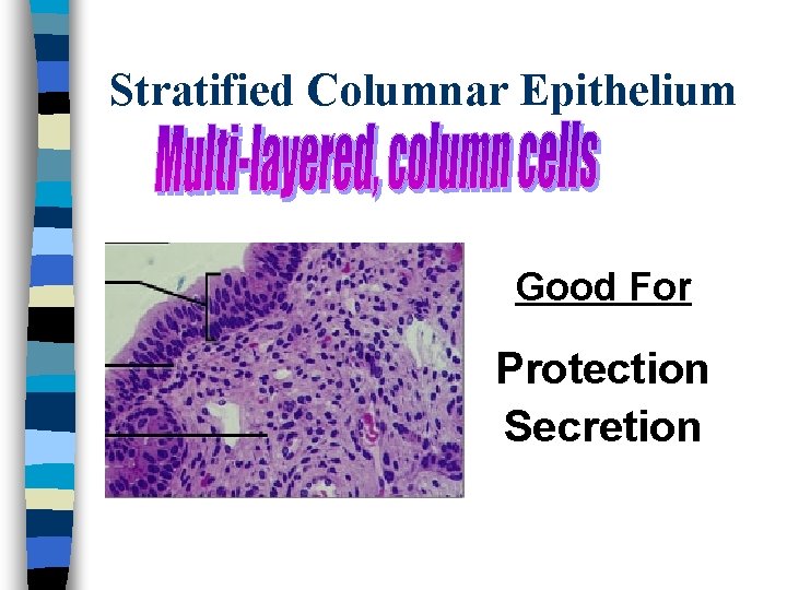 Stratified Columnar Epithelium Good For Protection Secretion 