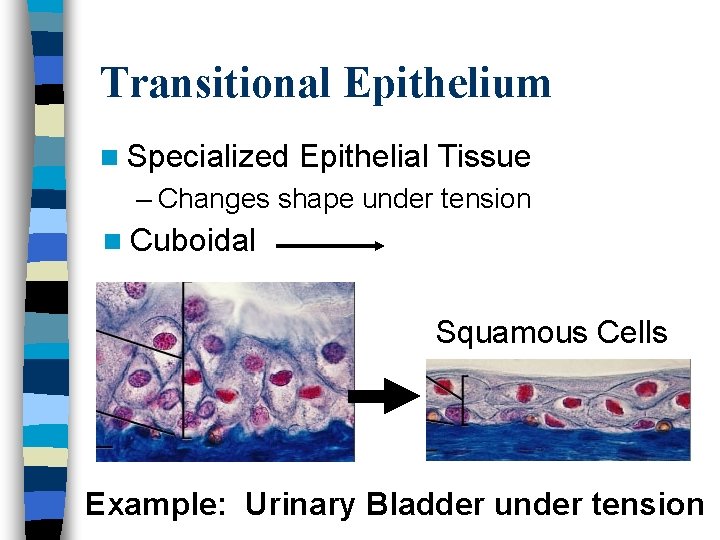 Transitional Epithelium n Specialized Epithelial Tissue – Changes shape under tension n Cuboidal Squamous