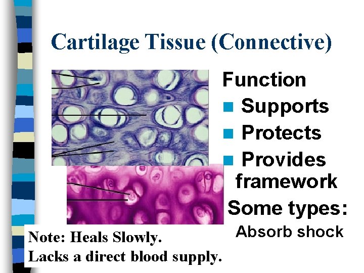 Cartilage Tissue (Connective) Function n Supports n Protects n Provides framework Some types: n