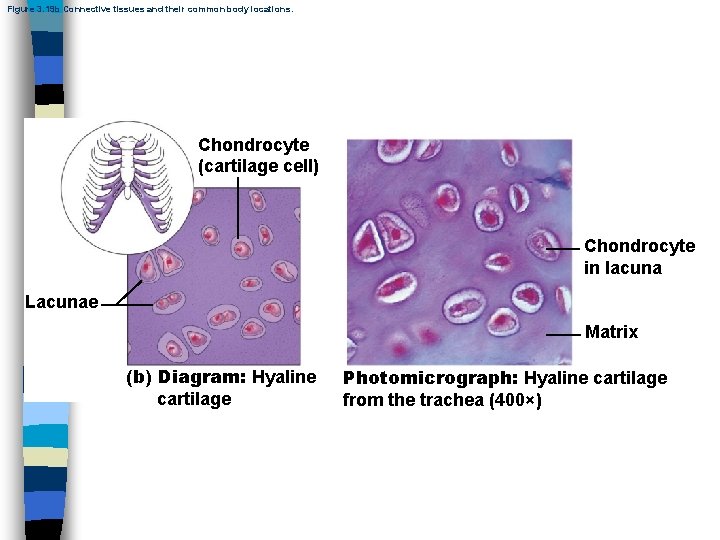 Figure 3. 19 b Connective tissues and their common body locations. Chondrocyte (cartilage cell)