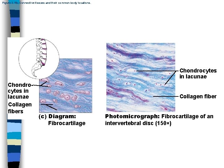 Figure 3. 19 c Connective tissues and their common body locations. Chondrocytes in lacunae