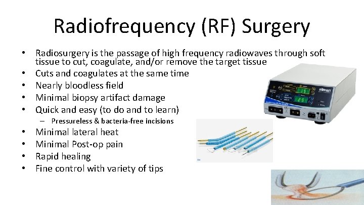 Radiofrequency (RF) Surgery • Radiosurgery is the passage of high frequency radiowaves through soft