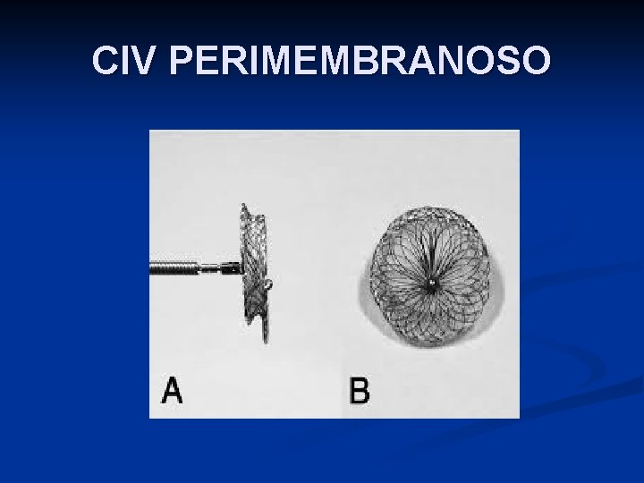 CIV PERIMEMBRANOSO 