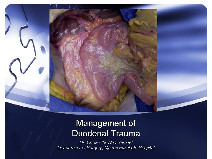 Management of Duodenal Trauma Dr. Chow Chi Woo Samuel Department of Surgery, Queen Elizabeth Management of Duodenal Trauma Dr. Chow Chi Woo Samuel Department of Surgery, Queen Elizabeth
