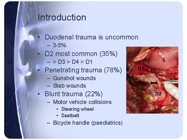 Introduction • Duodenal trauma is uncommon – 3 -5% • D 2 most common Introduction • Duodenal trauma is uncommon – 3 -5% • D 2 most common