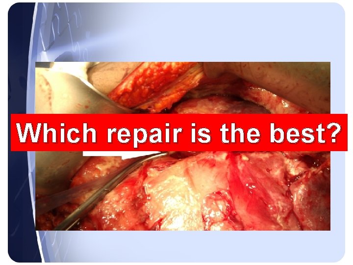 Which repair is the best? Which repair is the best?