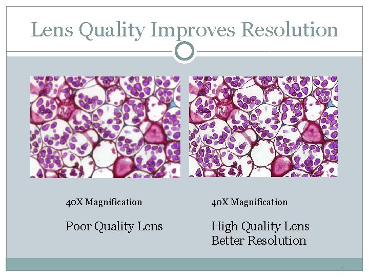 Lens Quality Improves Resolution 40 X Magnification Poor Quality Lens High Quality Lens Better Lens Quality Improves Resolution 40 X Magnification Poor Quality Lens High Quality Lens Better