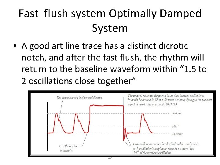 Fast flush system Optimally Damped System • A good art line trace has a