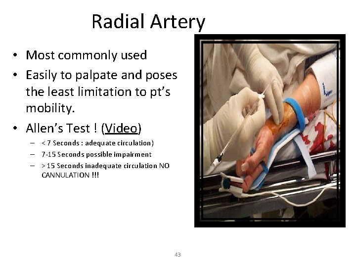 Radial Artery • Most commonly used • Easily to palpate and poses the least