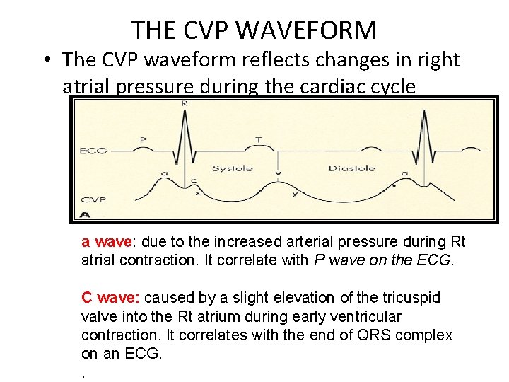 THE CVP WAVEFORM • The CVP waveform reflects changes in right atrial pressure during