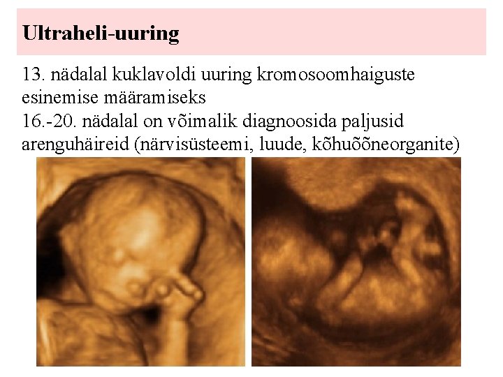 Ultraheli-uuring 13. nädalal kuklavoldi uuring kromosoomhaiguste esinemise määramiseks 16. -20. nädalal on võimalik diagnoosida