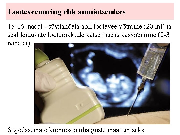 Looteveeuuring ehk amniotsentees 15 -16. nädal - süstlanõela abil lootevee võtmine (20 ml) ja