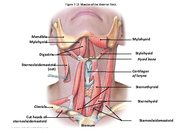 Figure 7 -13 Muscles of the Anterior Neck. Mandible Mylohyoid Stylohyoid Hyoid bone Digastric