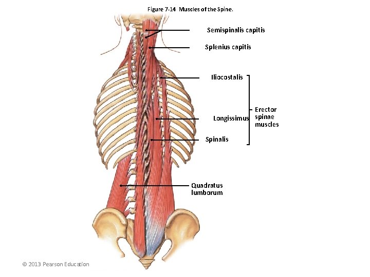 Figure 7 -14 Muscles of the Spine. Semispinalis capitis Splenius capitis Iliocostalis Erector Longissimus