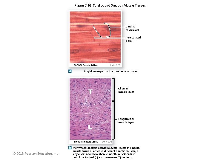 Figure 7 -10 Cardiac and Smooth Muscle Tissues. Cardiac muscle cell Intercalated discs Cardiac