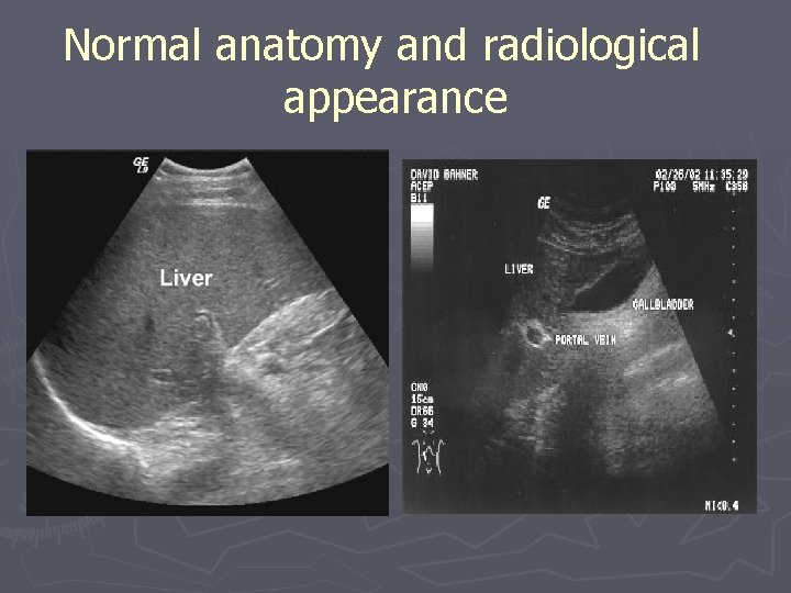 Normal anatomy and radiological appearance 