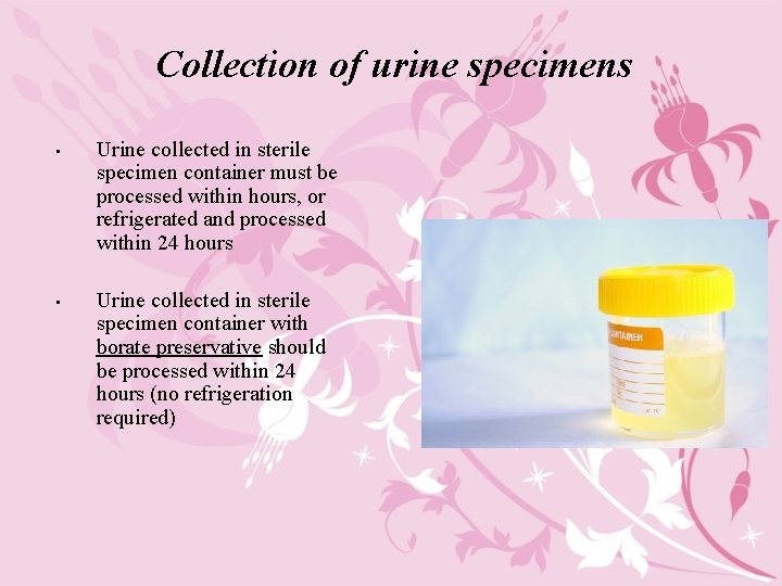 Collection of urine specimens • Urine collected in sterile specimen container must be processed