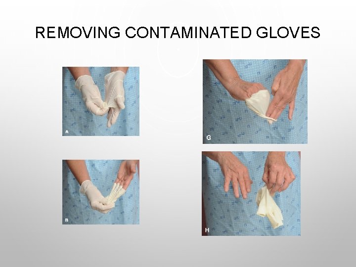 REMOVING CONTAMINATED GLOVES 