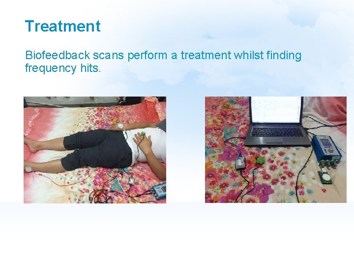 Treatment Biofeedback scans perform a treatment whilst finding frequency hits. 