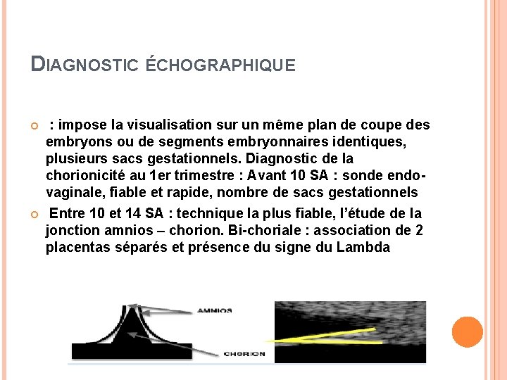 DIAGNOSTIC ÉCHOGRAPHIQUE : impose la visualisation sur un même plan de coupe des embryons
