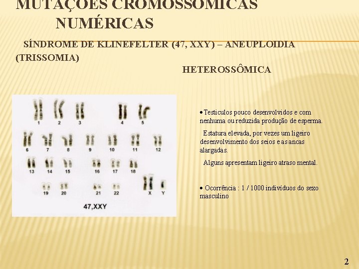 MUTAÇÕES CROMOSSÓMICAS NUMÉRICAS SÍNDROME DE KLINEFELTER (47, XXY) – ANEUPLOIDIA (TRISSOMIA) HETEROSSÔMICA Testiculos pouco