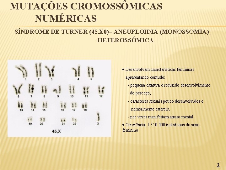 MUTAÇÕES CROMOSSÔMICAS NUMÉRICAS SÍNDROME DE TURNER (45, X 0)– ANEUPLOIDIA (MONOSSOMIA) HETEROSSÔMICA Desenvolvem características